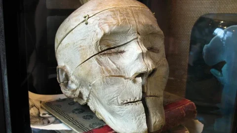 Museu Mütter